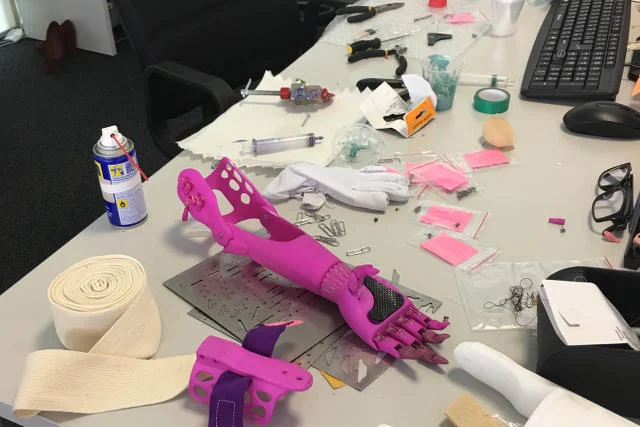 Proteza dziecięca wykonana metodą druku 3D w Skołkowo