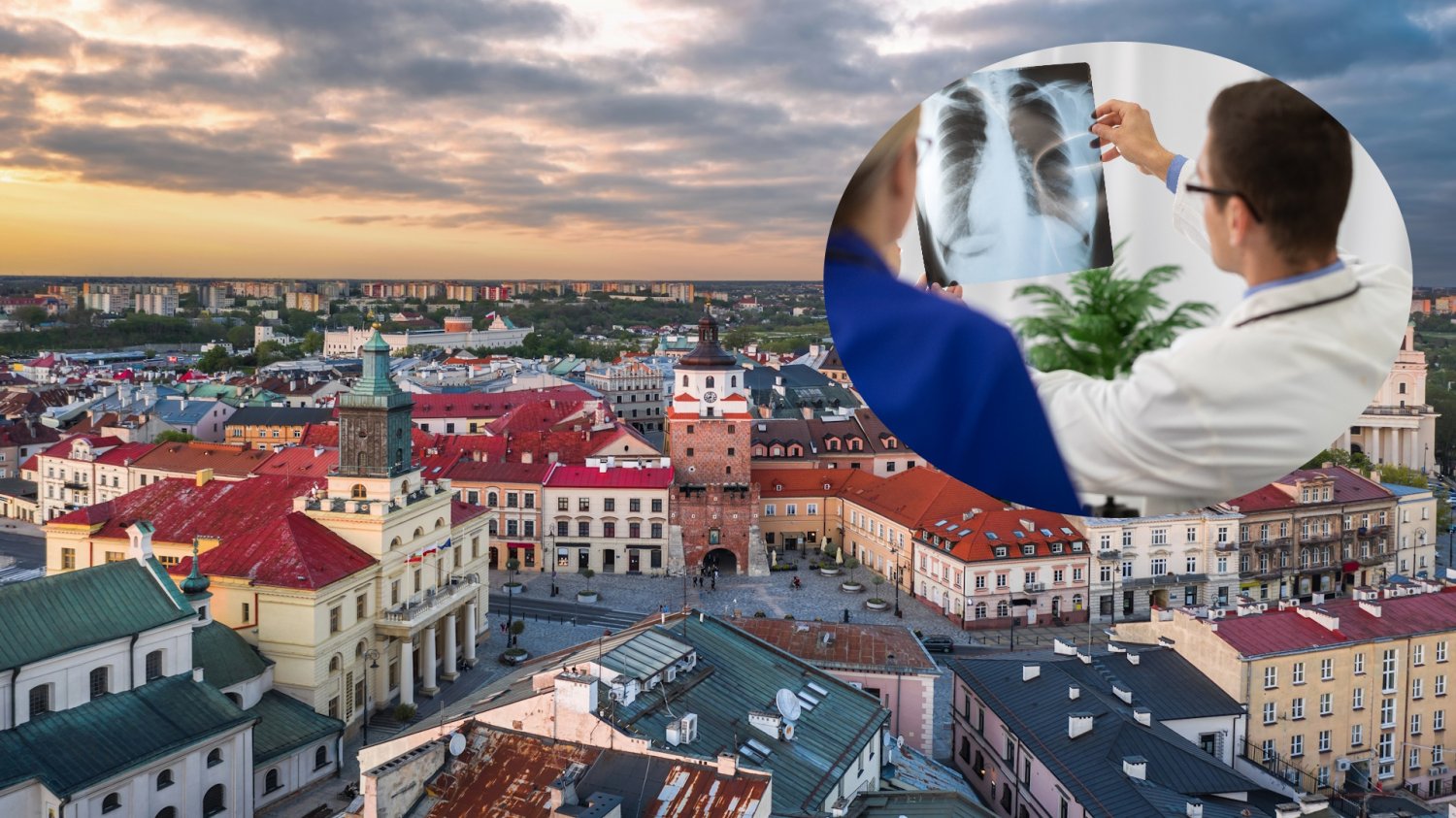 Montaż panoramy Lublina z wklejonym zdjęciem lekarza trzymającego zdjęcie rentgenowskie płuc. Polska Wschodnia z nowym centrum pulmonologii. Otwarto inwestycję za 36 milionów w Lublinie.