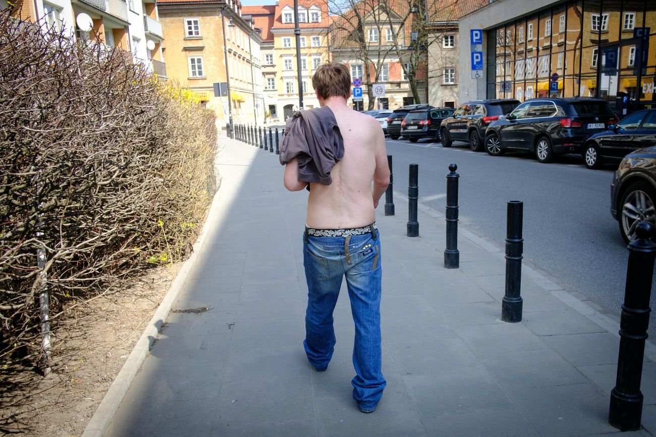 Za nadmierne epatowanie golizną można dostać mandat.