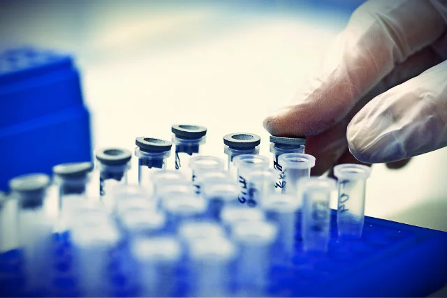 Próbki przygotowywane do detekcji DNA