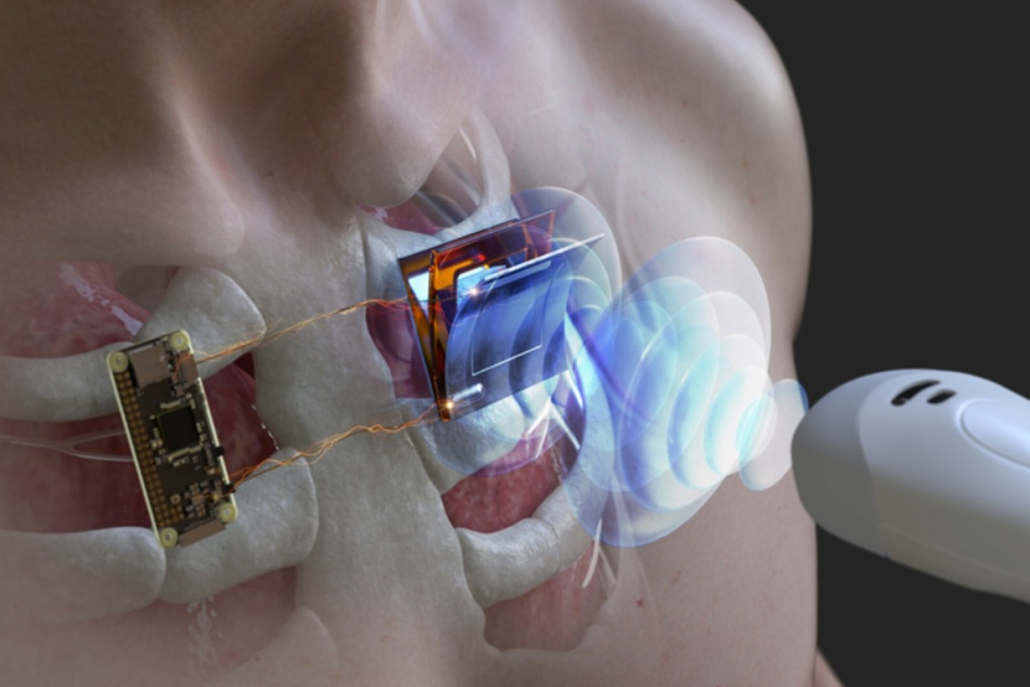 Biotechnologie rozwijają cyberhumanizm. Rośnie ryzyko cyberataków