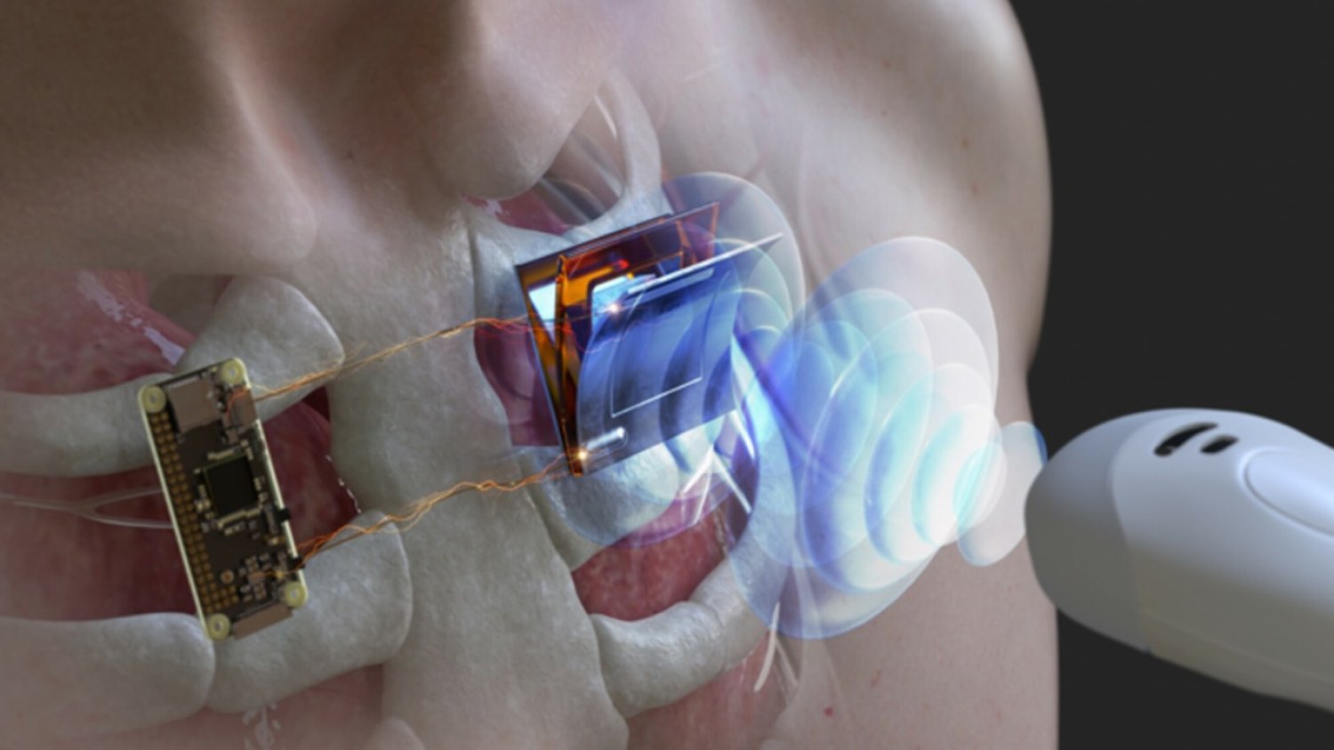 Biotechnologie rozwijają cyberhumanizm. Rośnie ryzyko cyberataków