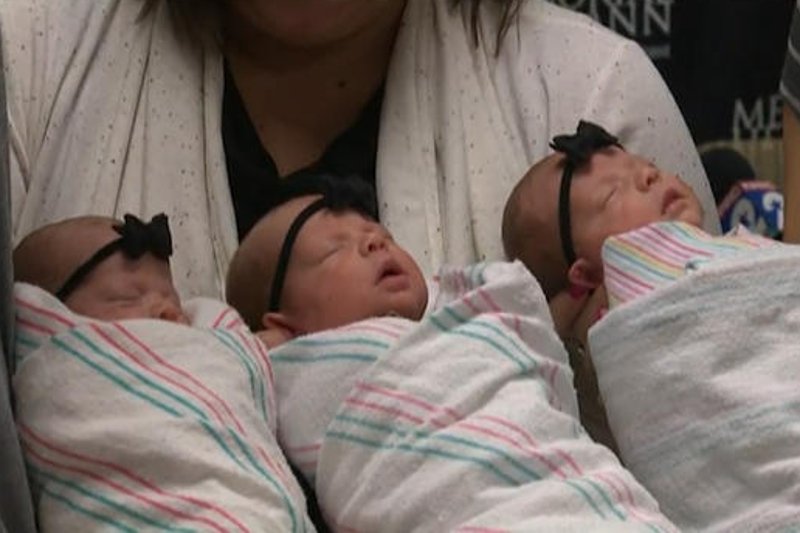 Trojaczki, jakie przyszły na świat w jednym ze szpitali w Houston, to prawdziwy cud natury. Taki przypadek narodzin zdarza się raz na milion.
