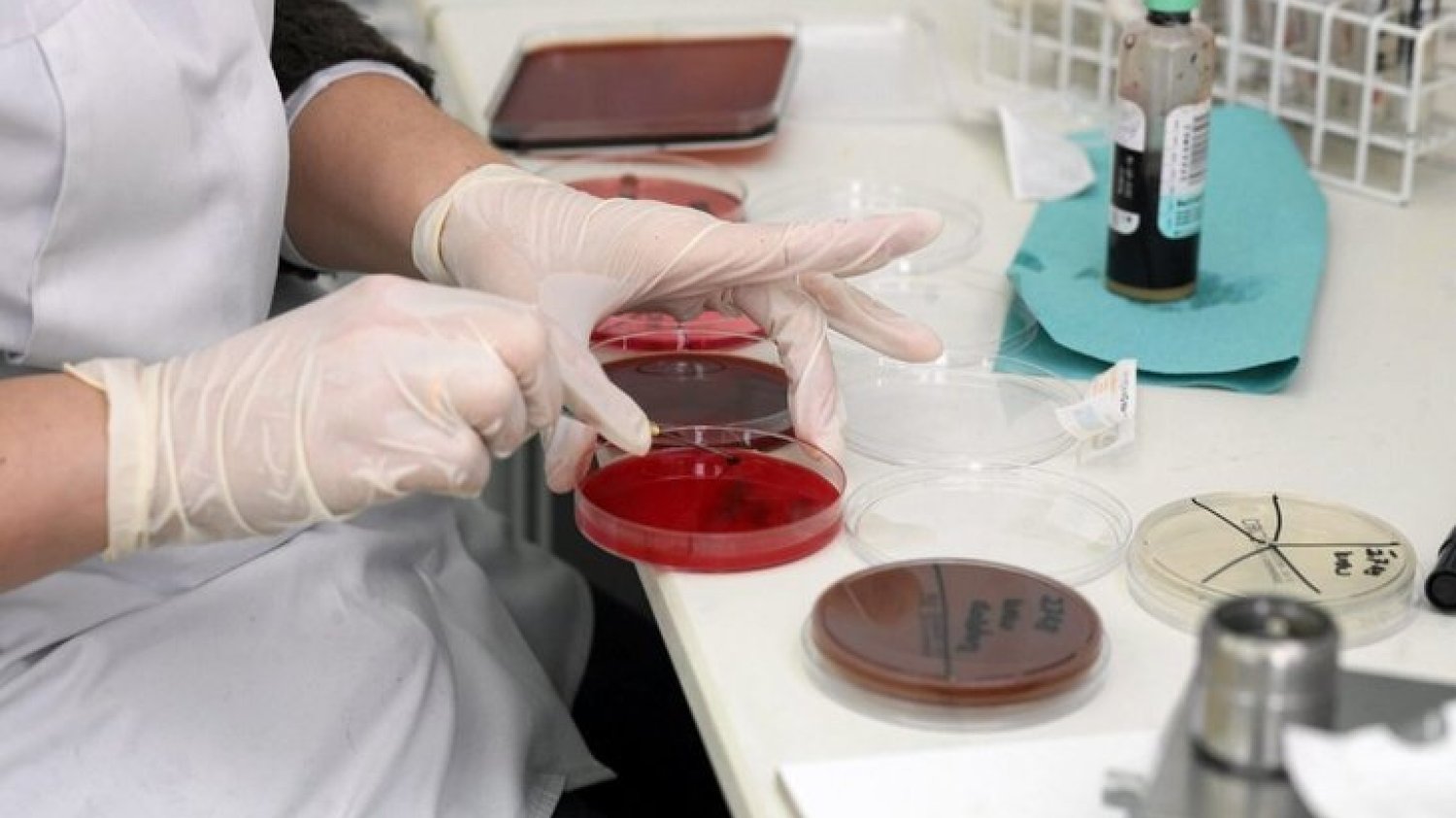 Przed debiutem, w roku 2016 OncoArendi Therapeutics miało 1,6 mln zł przychodów z działalności operacyjnej. Strata netto wyniosła wtedy 2,4 mln zł.