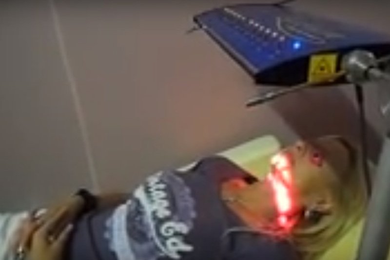 Metoda ma umożliwić m. in. usuwanie zmarszczek przy wykorzystaniu lasera.