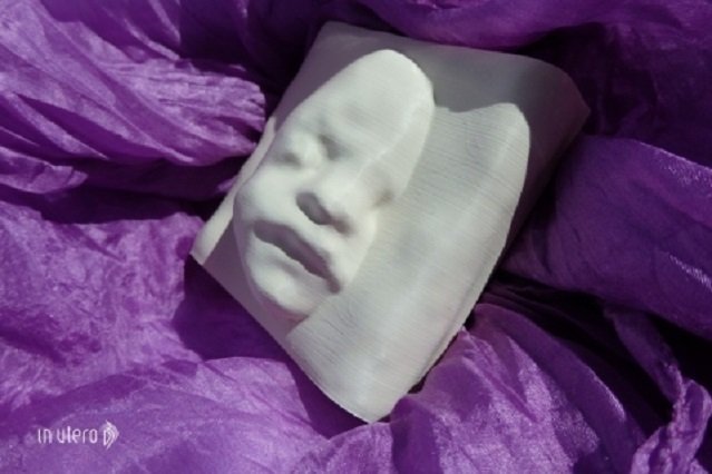 Tak wygląda płód, wydrukowany w 3D