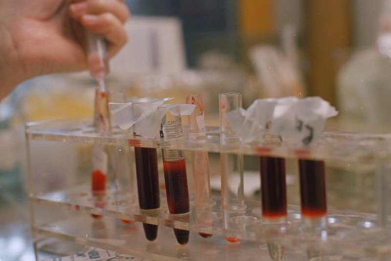 Naukowcy z Krakowa stworzyli wynalazek, który pozwoli błyskawicznie wykryć sepsę we krwi pacjenta.