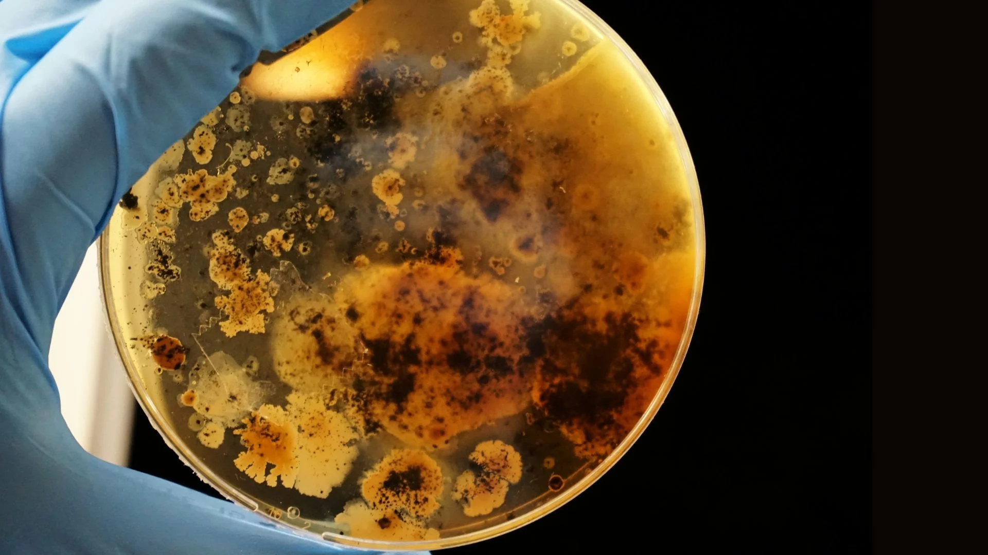 Bakterie są coraz bardziej odporne na leki, ostrzega WHO.