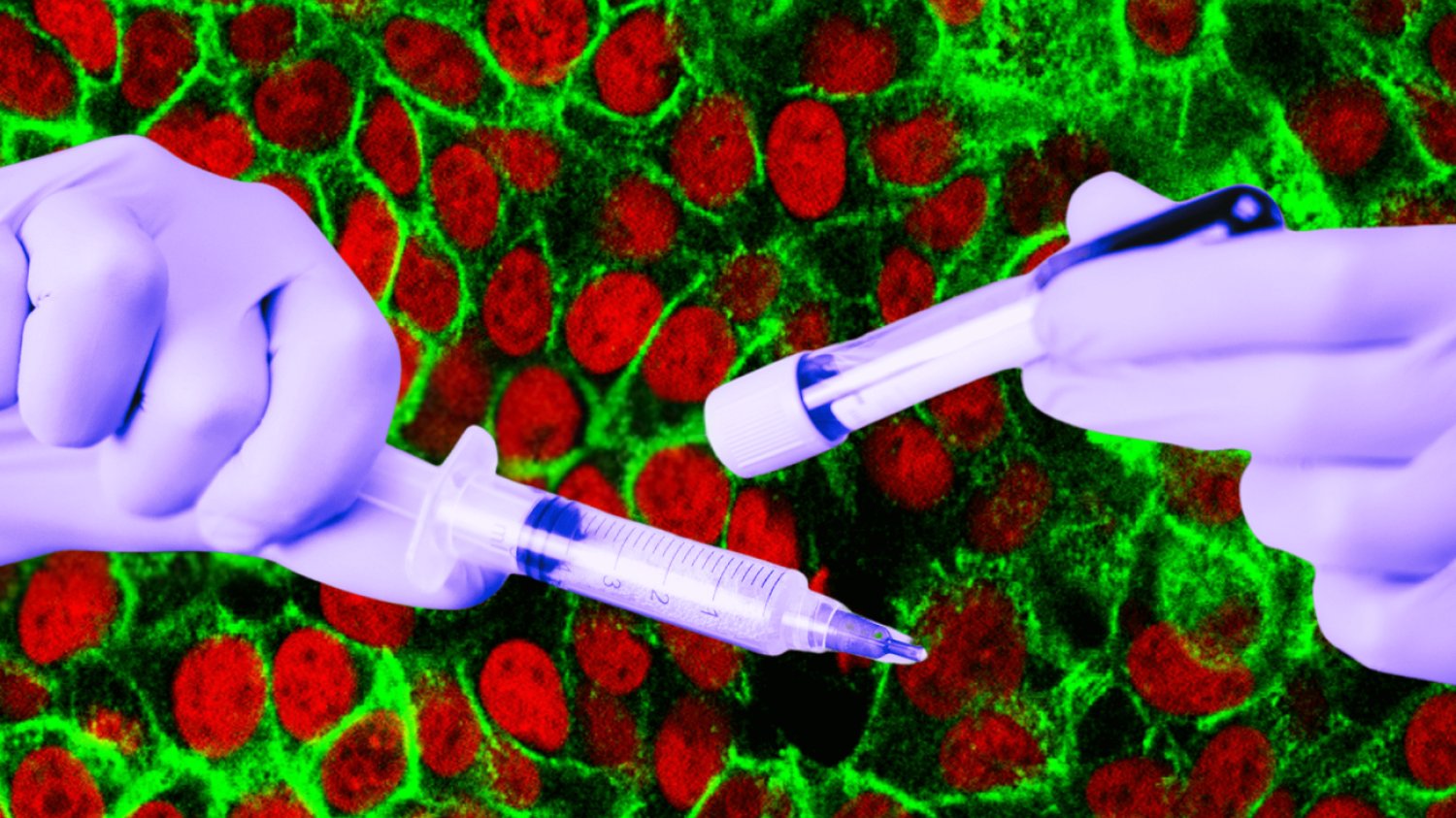 23andMe oraz dane genetyczne jej klientów kupiła firma biotechnologiczna Regeneron Pharmaceuticals za 256 mln dolarów. Choć kwota może robić wrażenie, to jednak niewiele w porównaniu z tym, ile firma była warta w szczytowym okresie jej popularności.