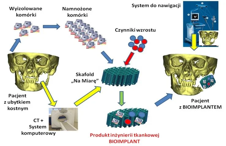 Schemat projektu Bioimplant
